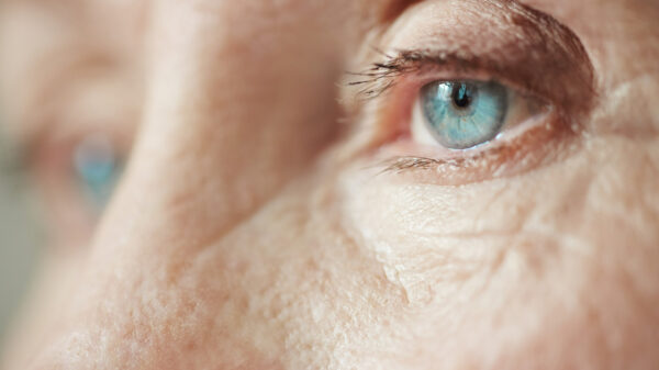 Cegueira - Conselho Brasileiro de Oftalmologia