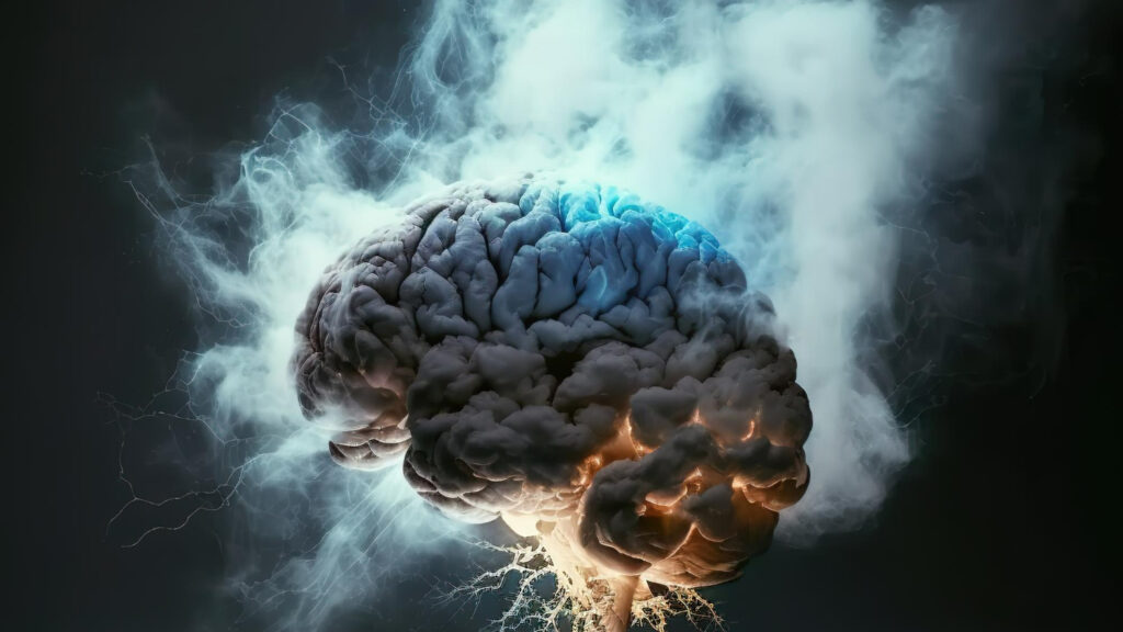 AVC - aneurismas - exames vasculares