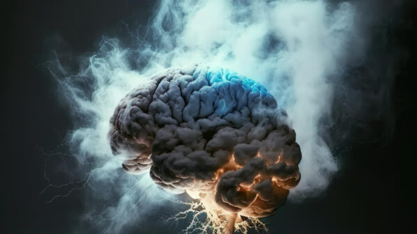 AVC - aneurismas - exames vasculares