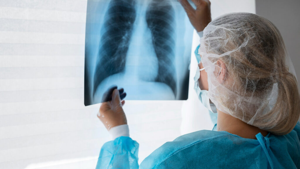 Tuberculose