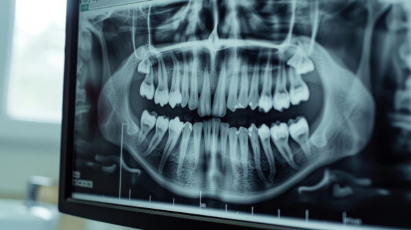 Dia Nacional da Saúde Bucal - equipamentos odontológicos GDF