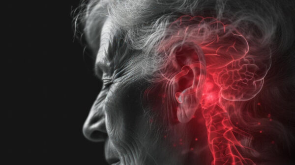 Acidente Vascular Cerebral (AVC)