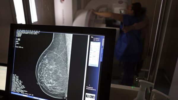 mamografia de rastreio câncer de mama