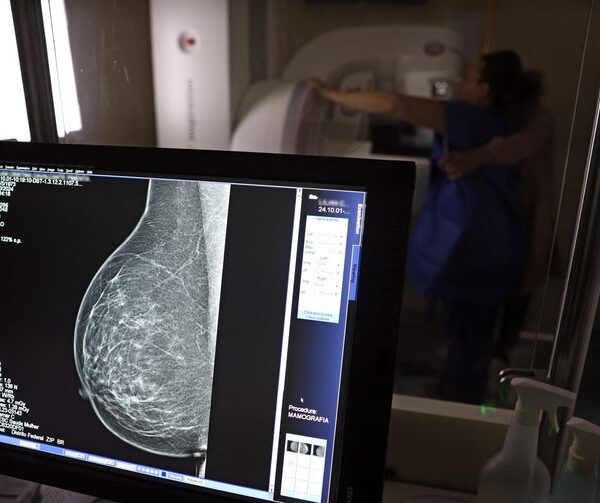 mamografia de rastreio câncer de mama