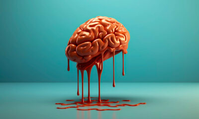 Acidente Vascular Cerebral (AVC)