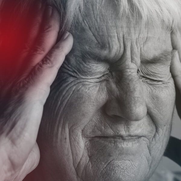 Acidente Vascular Cerebral (AVC)