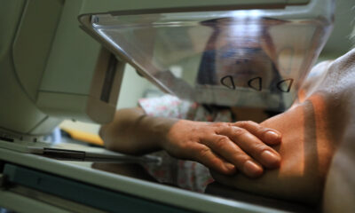 mamografia câncer de mama