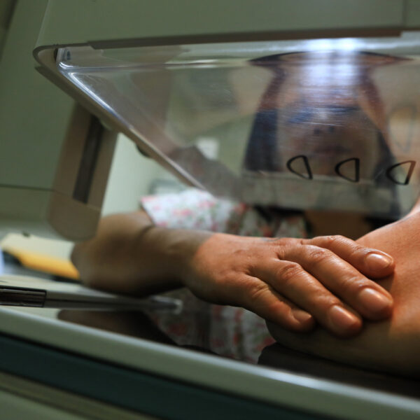 mamografia câncer de mama