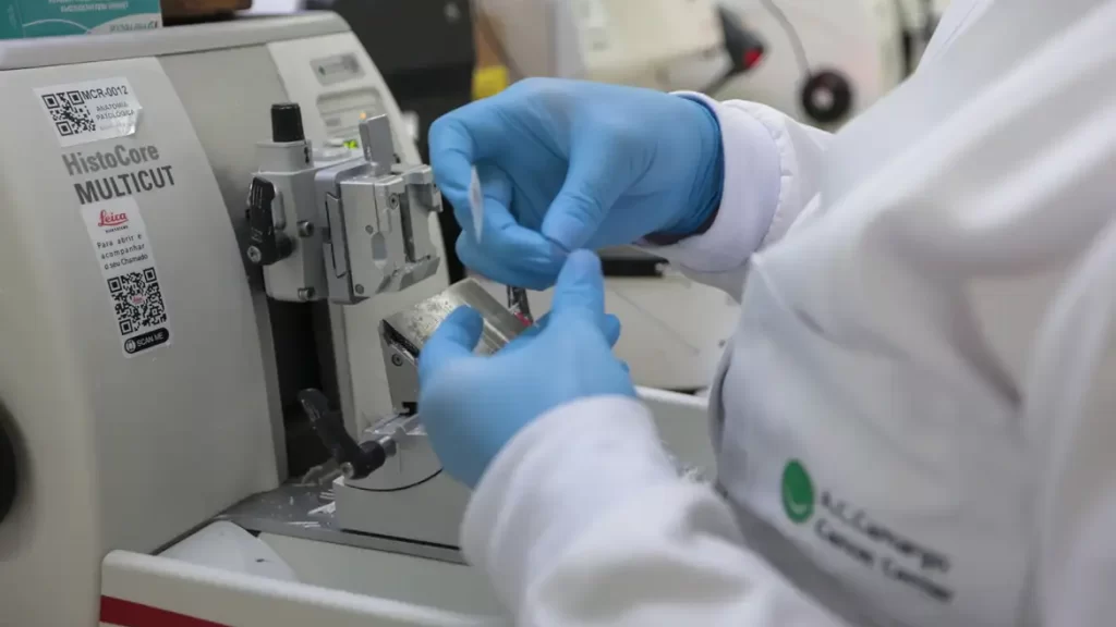 robótica câncer de próstata