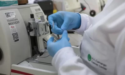 robótica câncer de próstata