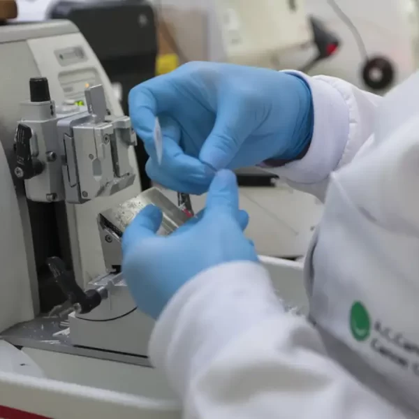 robótica câncer de próstata