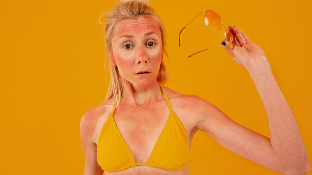 Dezembro Laranja câncer de pele verão