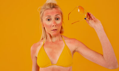 Dezembro Laranja câncer de pele verão