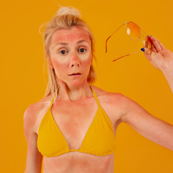 Dezembro Laranja câncer de pele verão