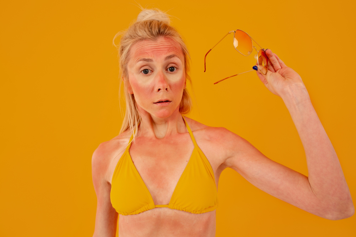 Dezembro Laranja câncer de pele verão