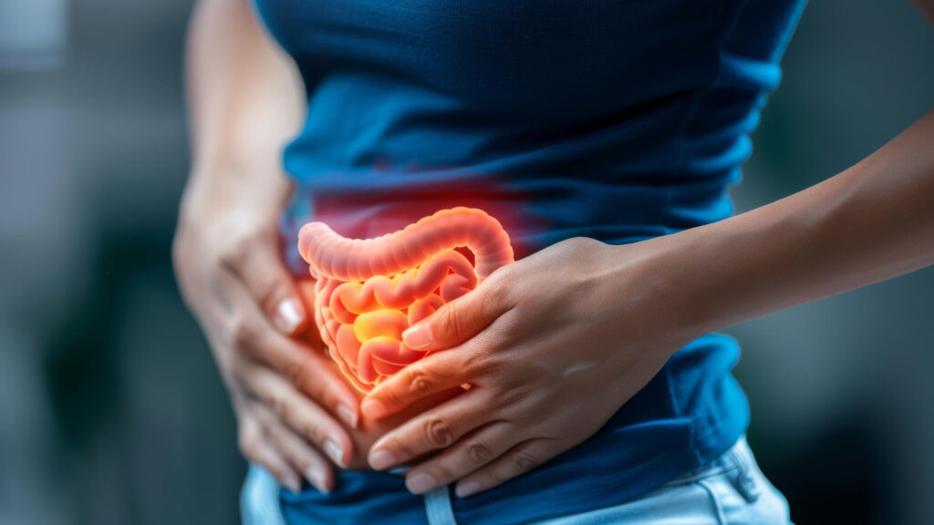 câncer de intestino