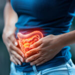 câncer de intestino