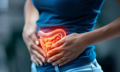 câncer de intestino