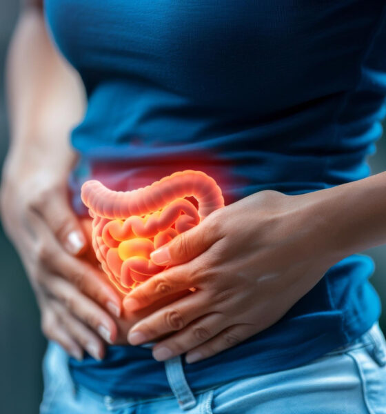 câncer de intestino