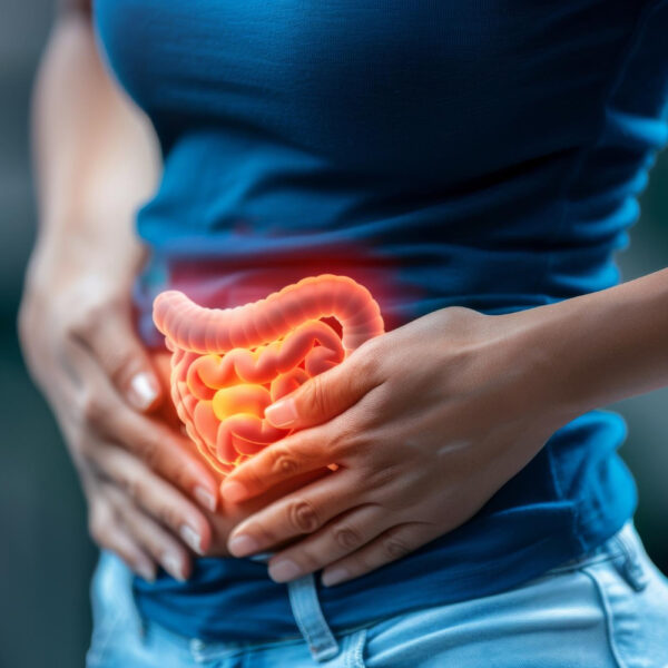 câncer de intestino