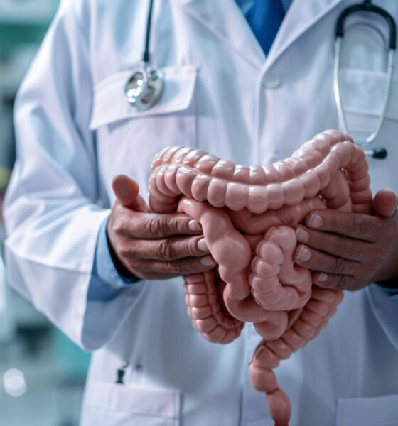 câncer de intestino câncer colorretal