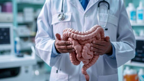 câncer de intestino câncer colorretal