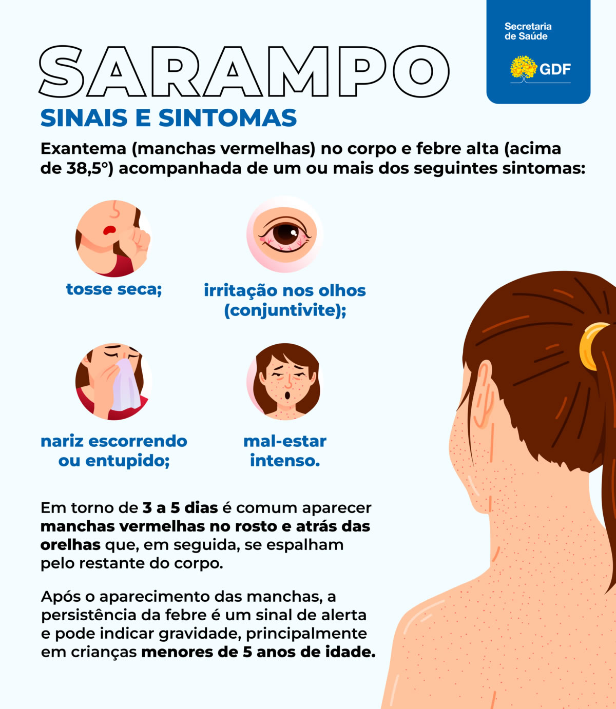 sinais e sintomas sarampo