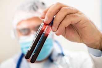 Junho Laranja reforça importância do diagnóstico precoce das doenças do sangue